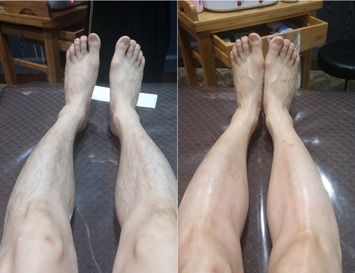 시드니왁싱 대표 이미지