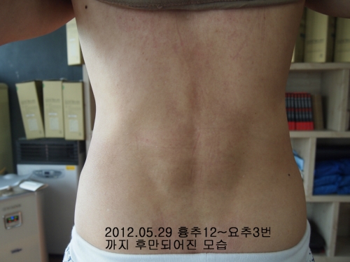 필척추운동