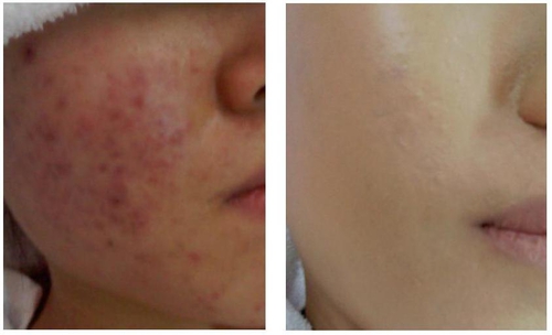 한방녹두피부관리 대표 이미지