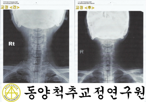 동양척추교정연구원
