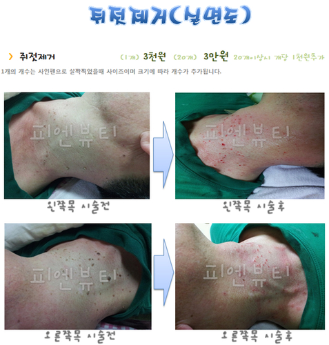 피엔뷰티 photo 2