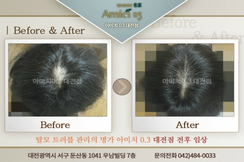 아미치0.3 대전점 대표 이미지