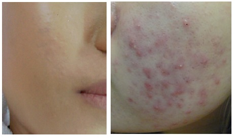 한방녹두피부관리 대표 이미지