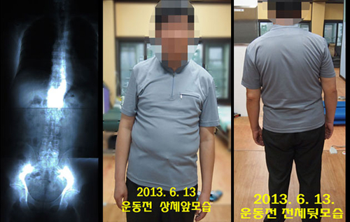 필척추운동