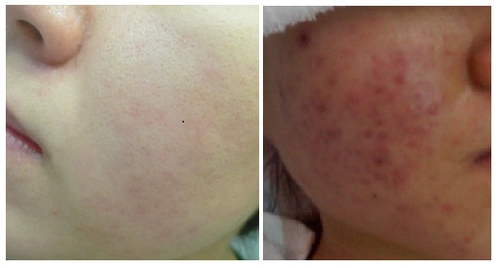 한방녹두피부관리 대표 이미지