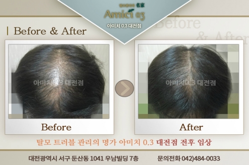 아미치0.3 대전점 대표 이미지