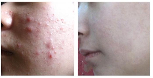 한방녹두피부관리 대표 이미지