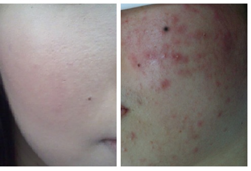 한방녹두피부관리 대표 이미지