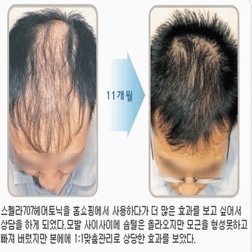 스팰라랜드 대표 이미지