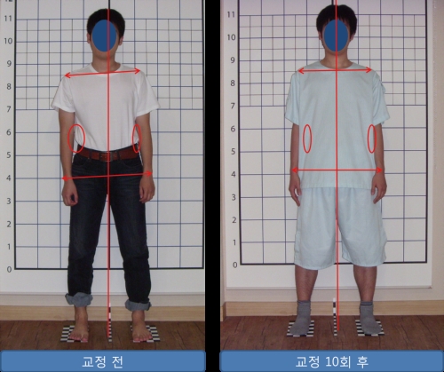 성진척추교정&바디워크 photo 7