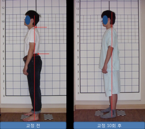 성진척추교정&바디워크 photo 8
