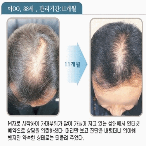 스팰라랜드 대표 이미지