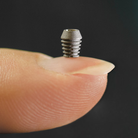 바이콘임플란트 대표 이미지