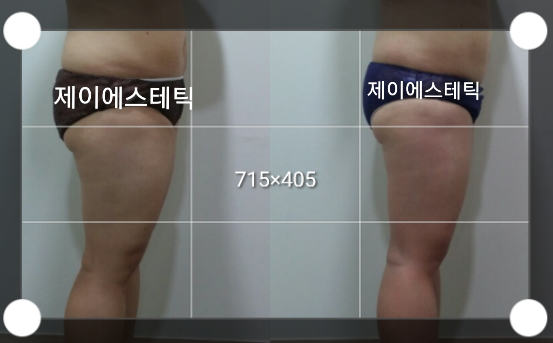 제이에스테틱 대표 이미지