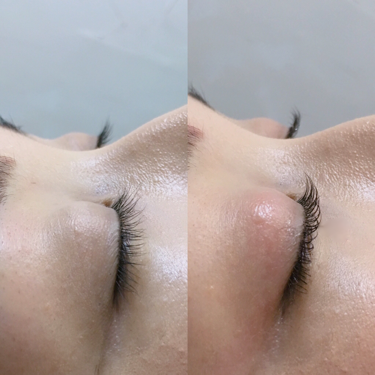 비래쉬 대표 이미지