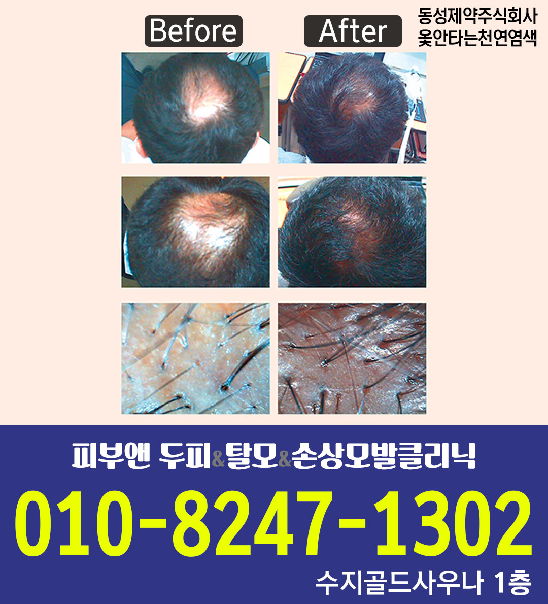 옻안타는천연염색 수지점