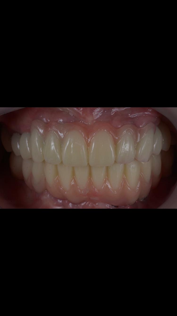 스마일디자인기공소 대표 이미지