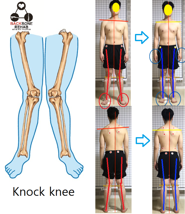 백본휘트니스 체형교정 대표 이미지