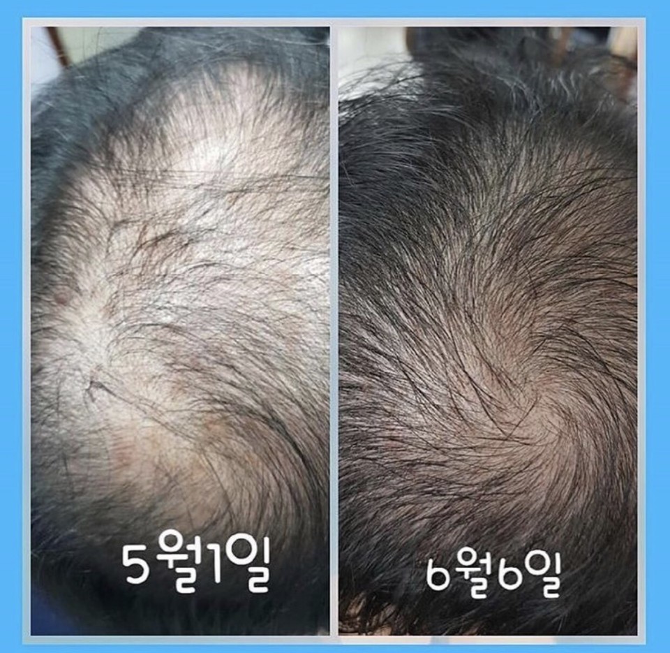 두피탈모&스킨케어 양장점 대표 이미지