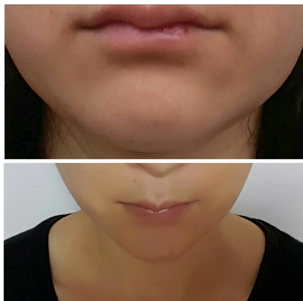 스와니예 이미지