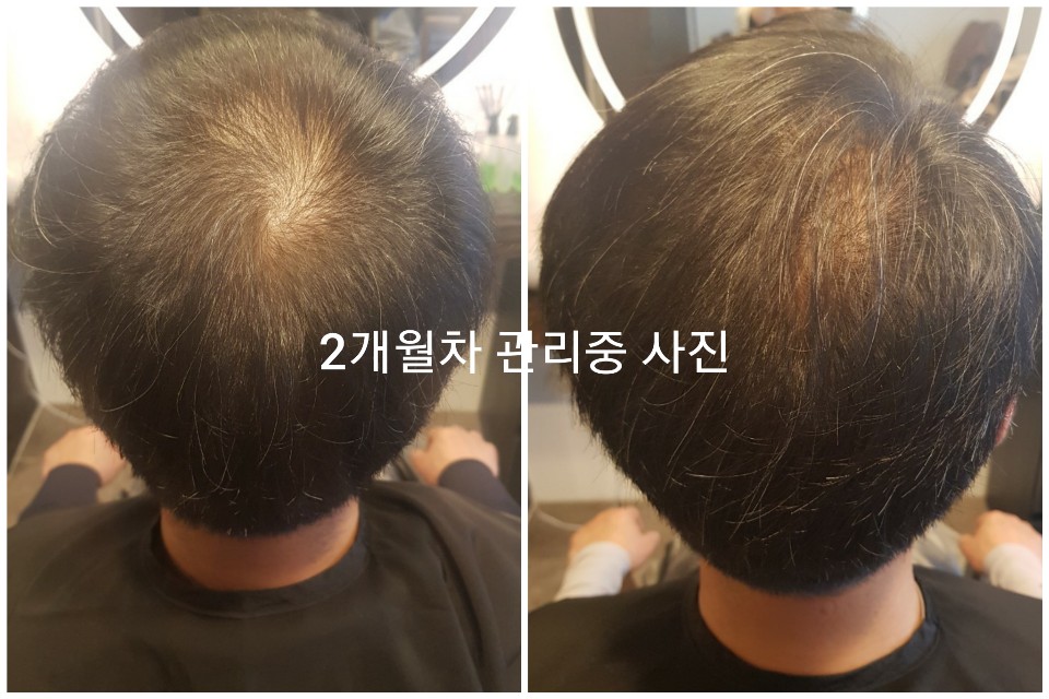 MGF두피탈모센터 광명하안점 대표 이미지