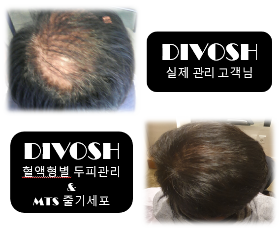 디보쉬
