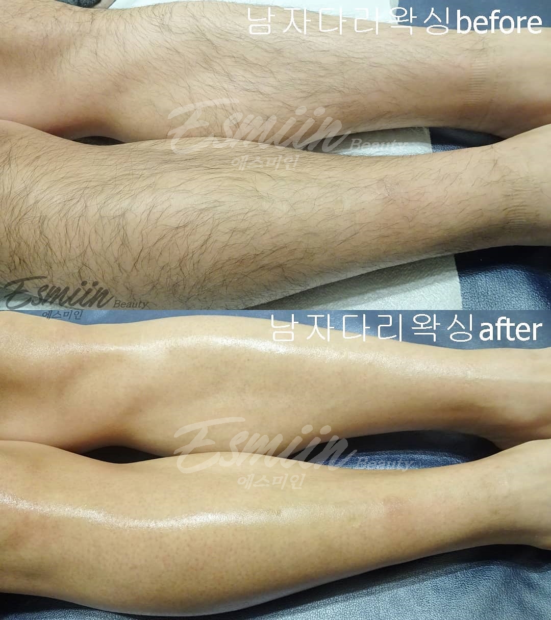에스미인왁싱&태닝