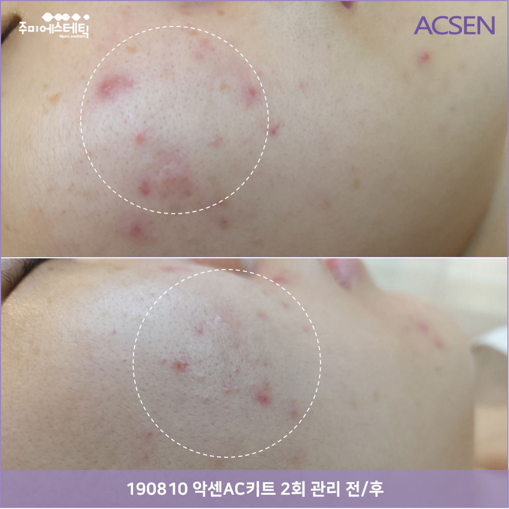 더마클리어센터 과천점 대표 이미지