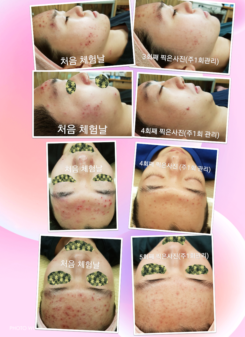 뷰티스토리