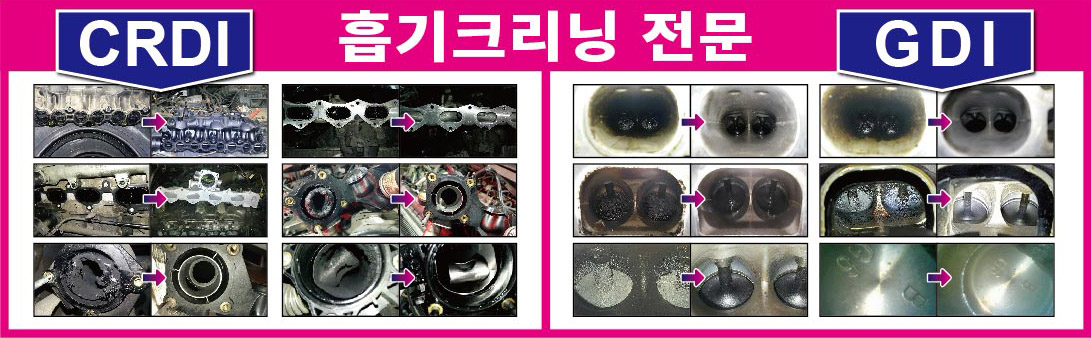 경희카클리닉청대카