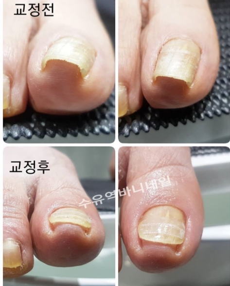 바니네일