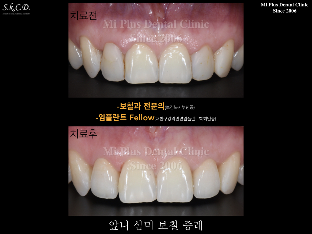 미플러스치과의원 대표 이미지