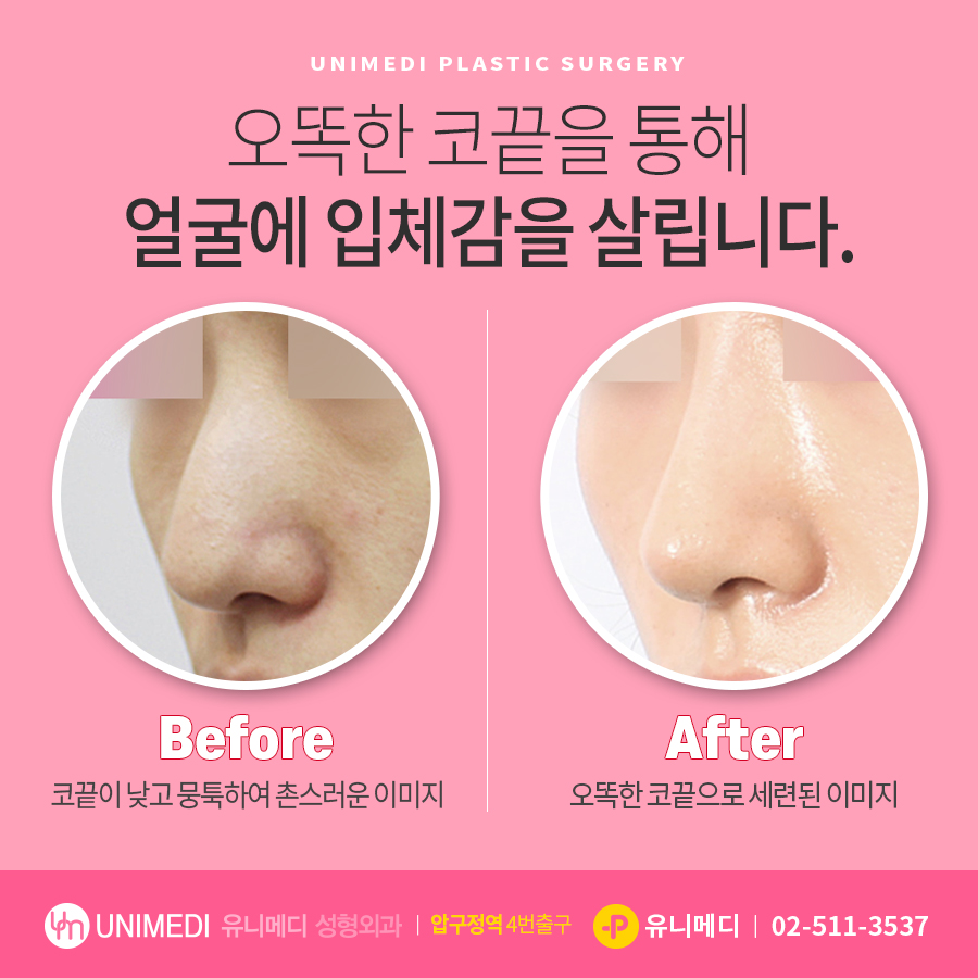 유니메디성형외과의원 대표 이미지