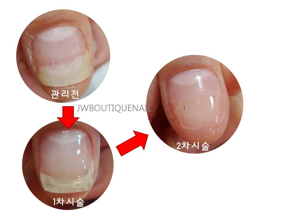 에러퍼펙트 서현점
