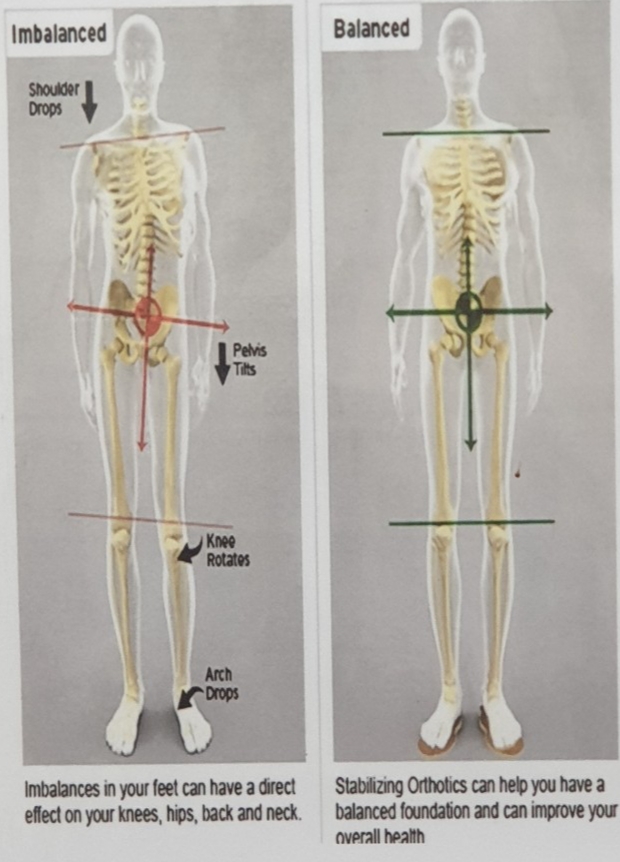 알즈너 강건대리점