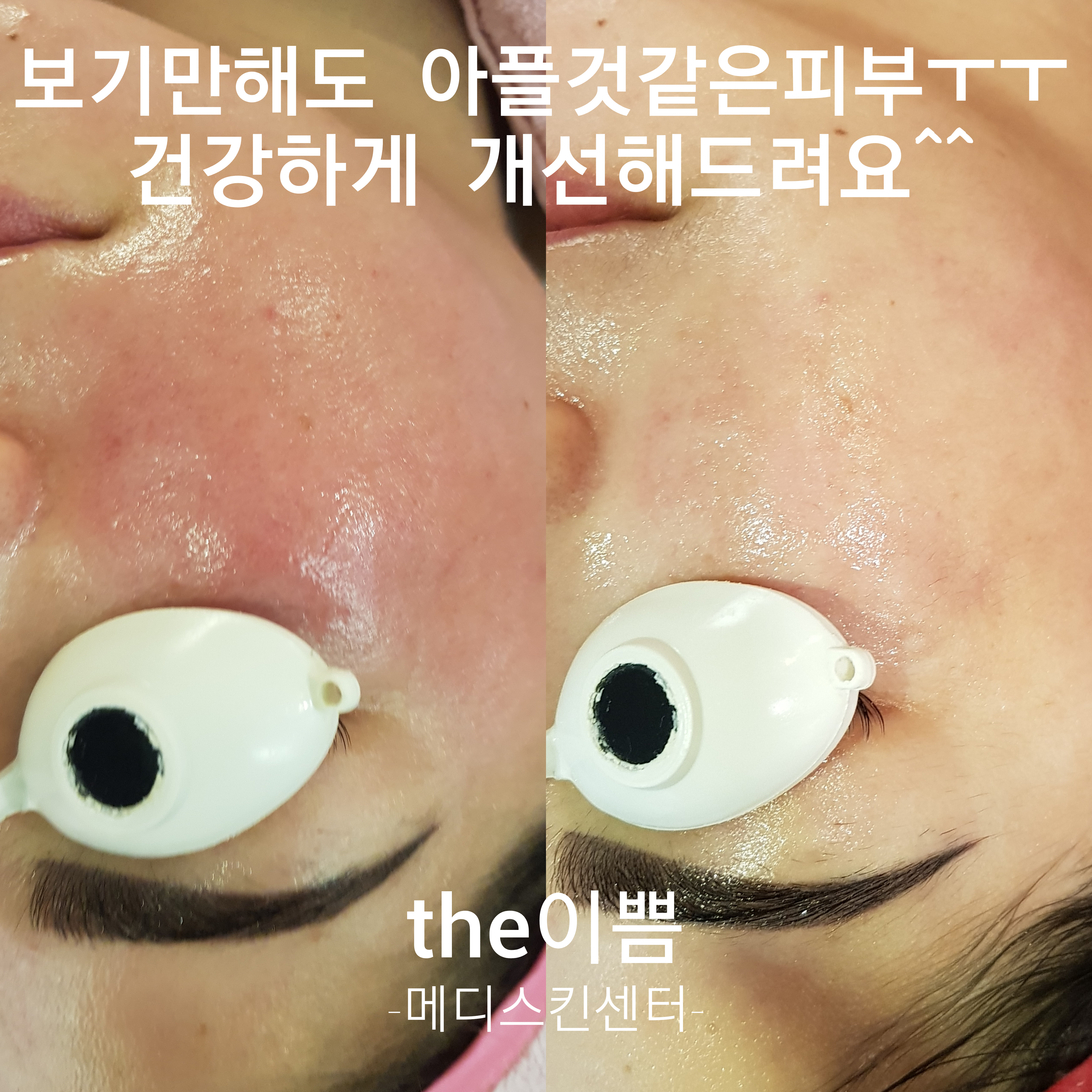 the이쁨 대표 이미지