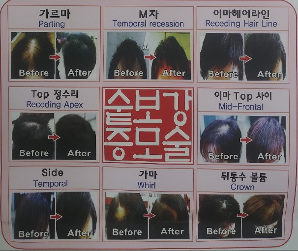 행복한머리 대표 이미지