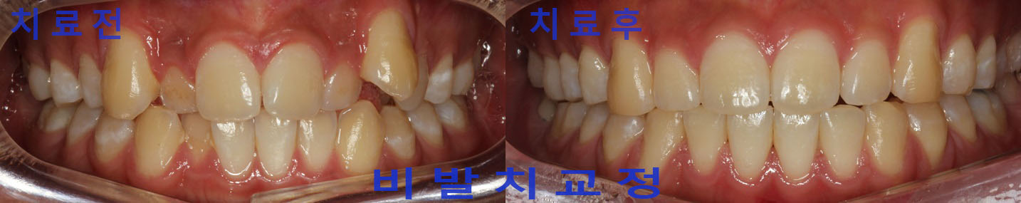 하이치과의원 대표 이미지