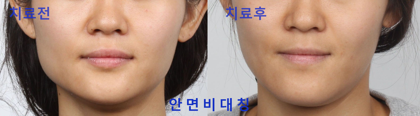 하이치과의원 대표 이미지
