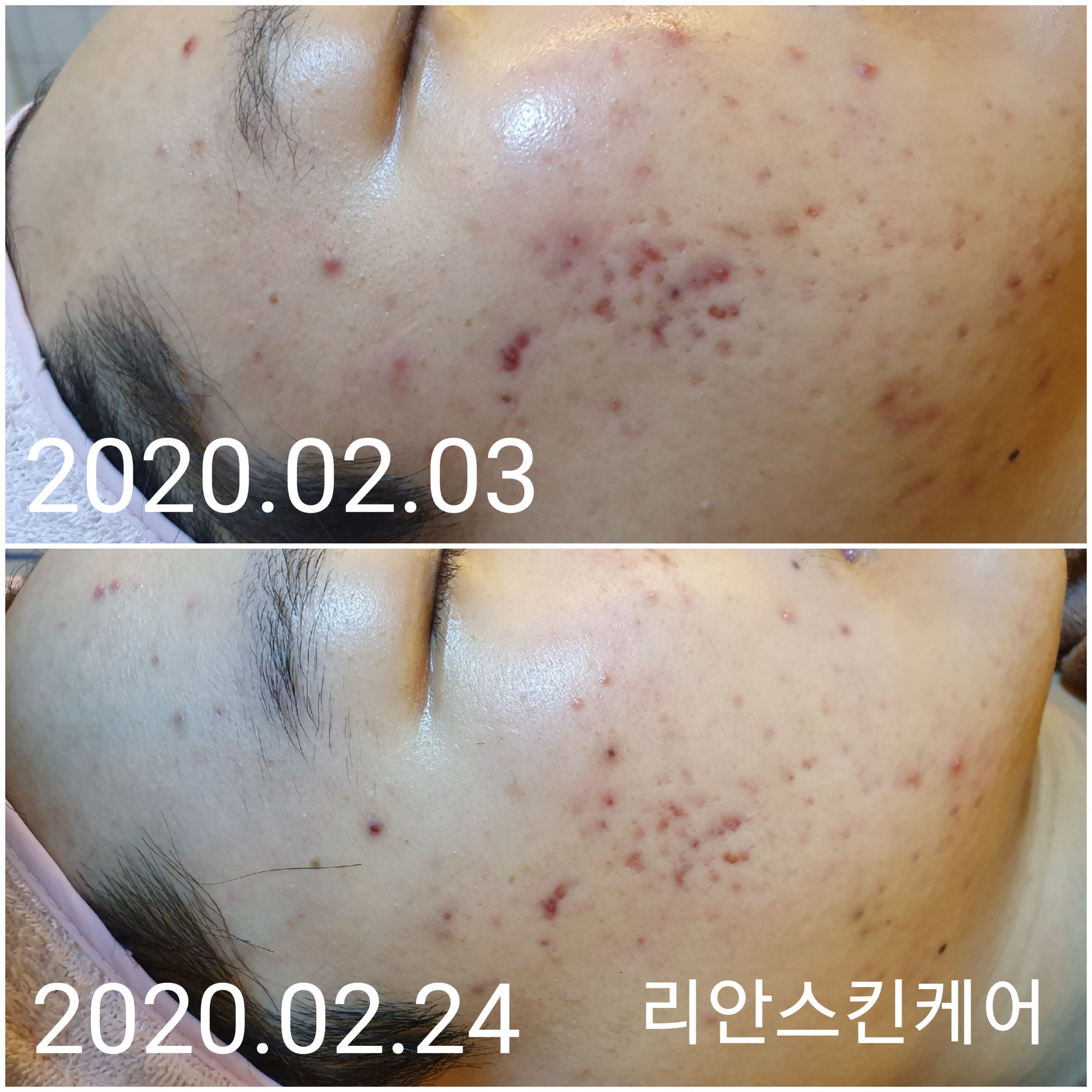 리안스킨케어 대표 이미지