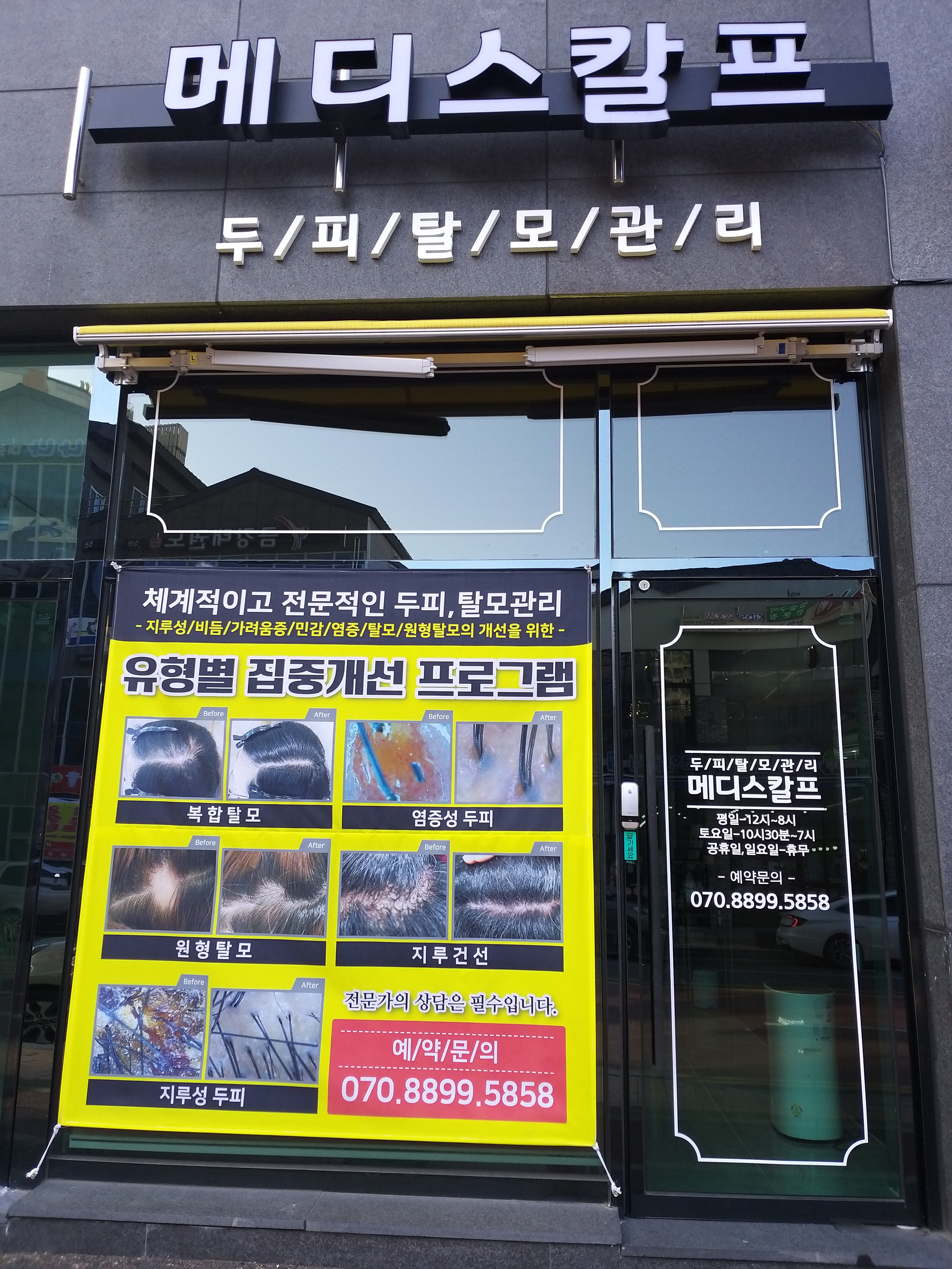 메디스칼프