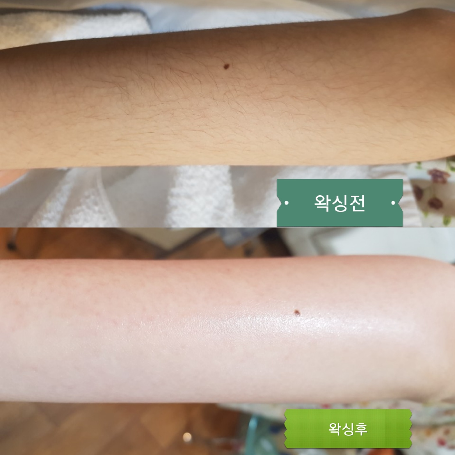고운손길 피부관리 대표 이미지