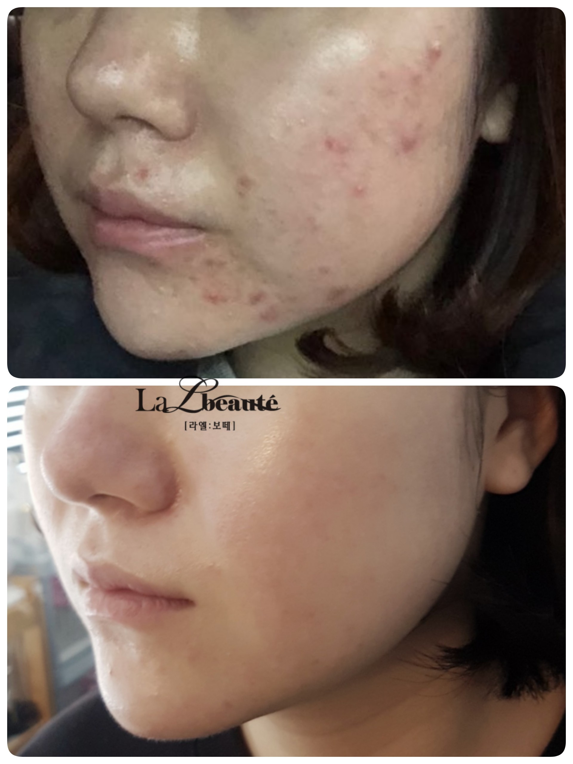 라엘보떼 대표 이미지