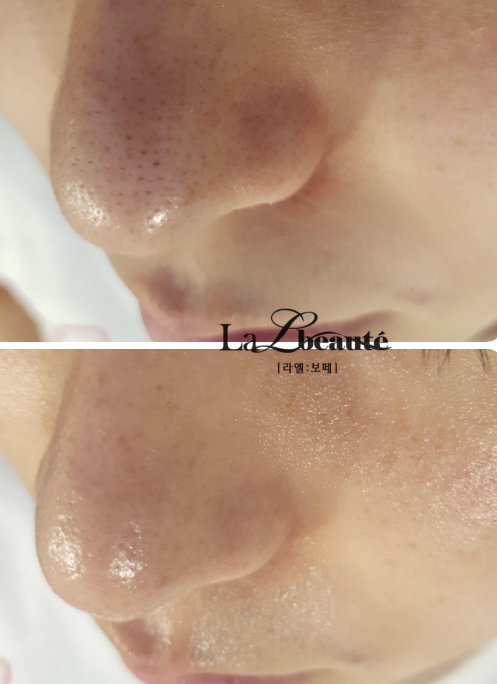 라엘보떼 대표 이미지