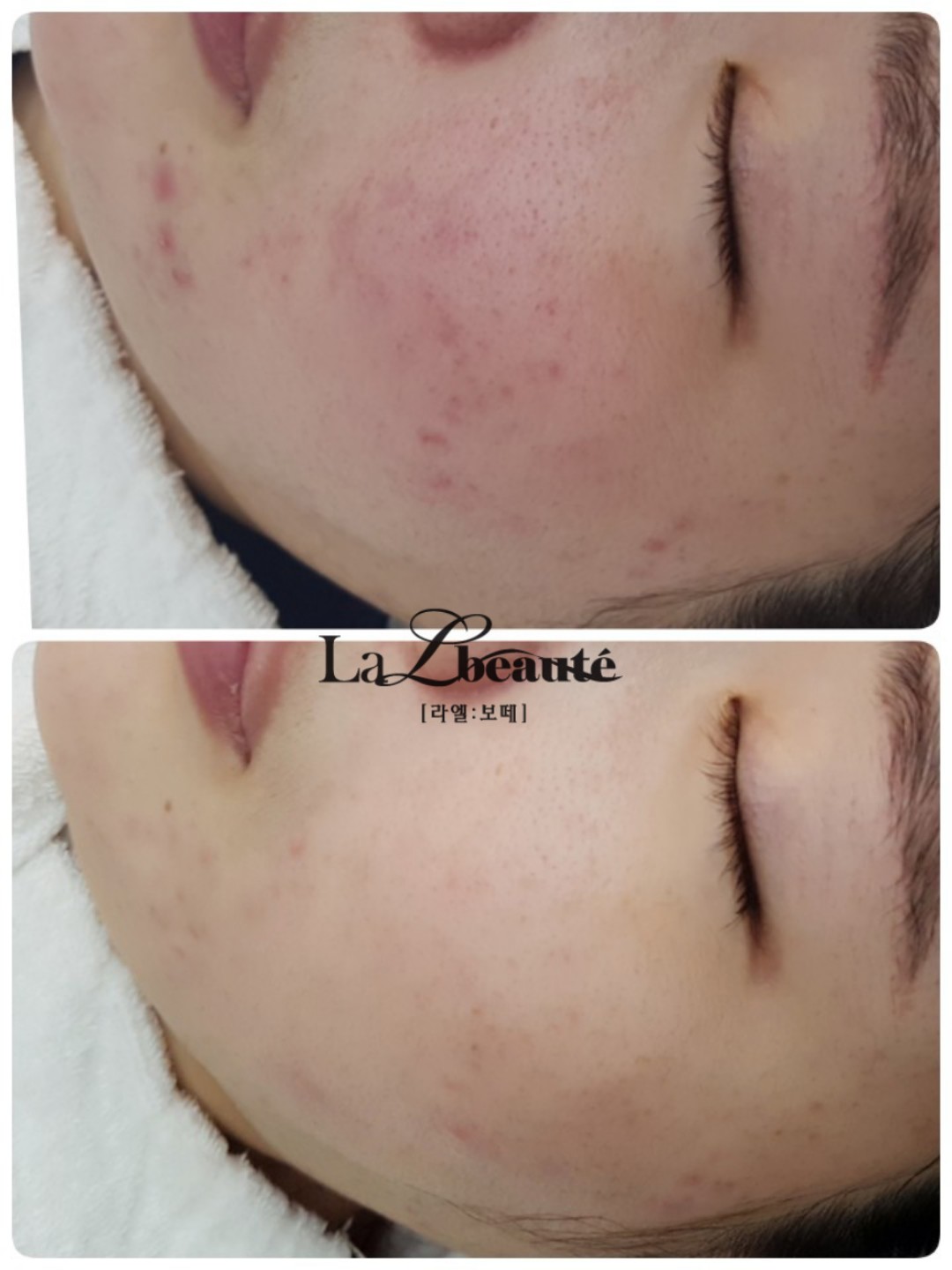 라엘보떼 대표 이미지