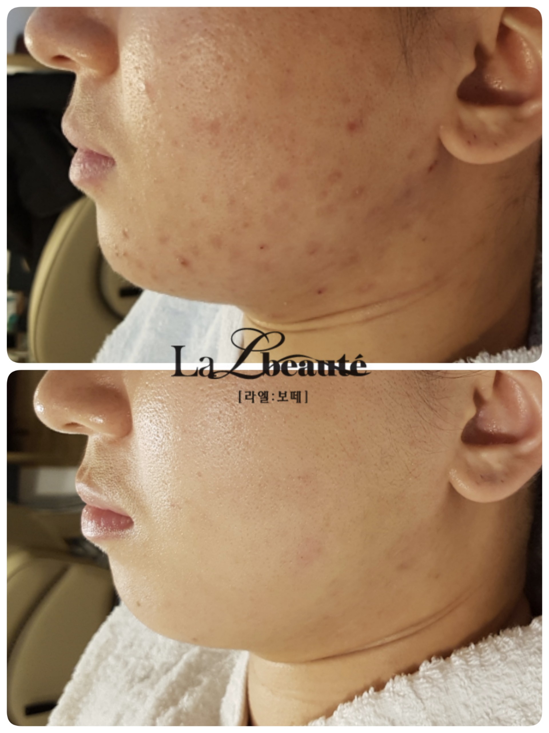 라엘보떼 대표 이미지