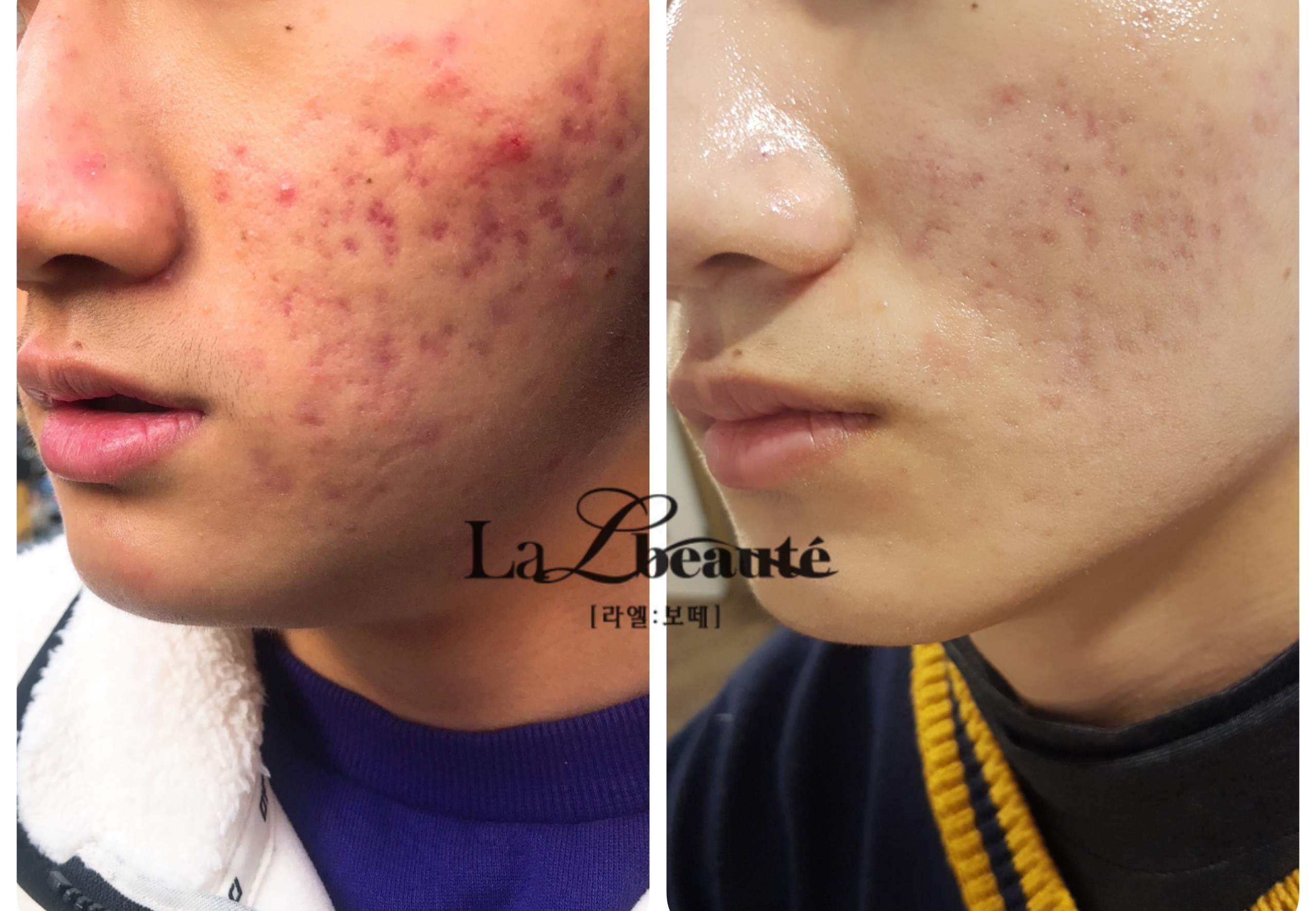 라엘보떼 대표 이미지