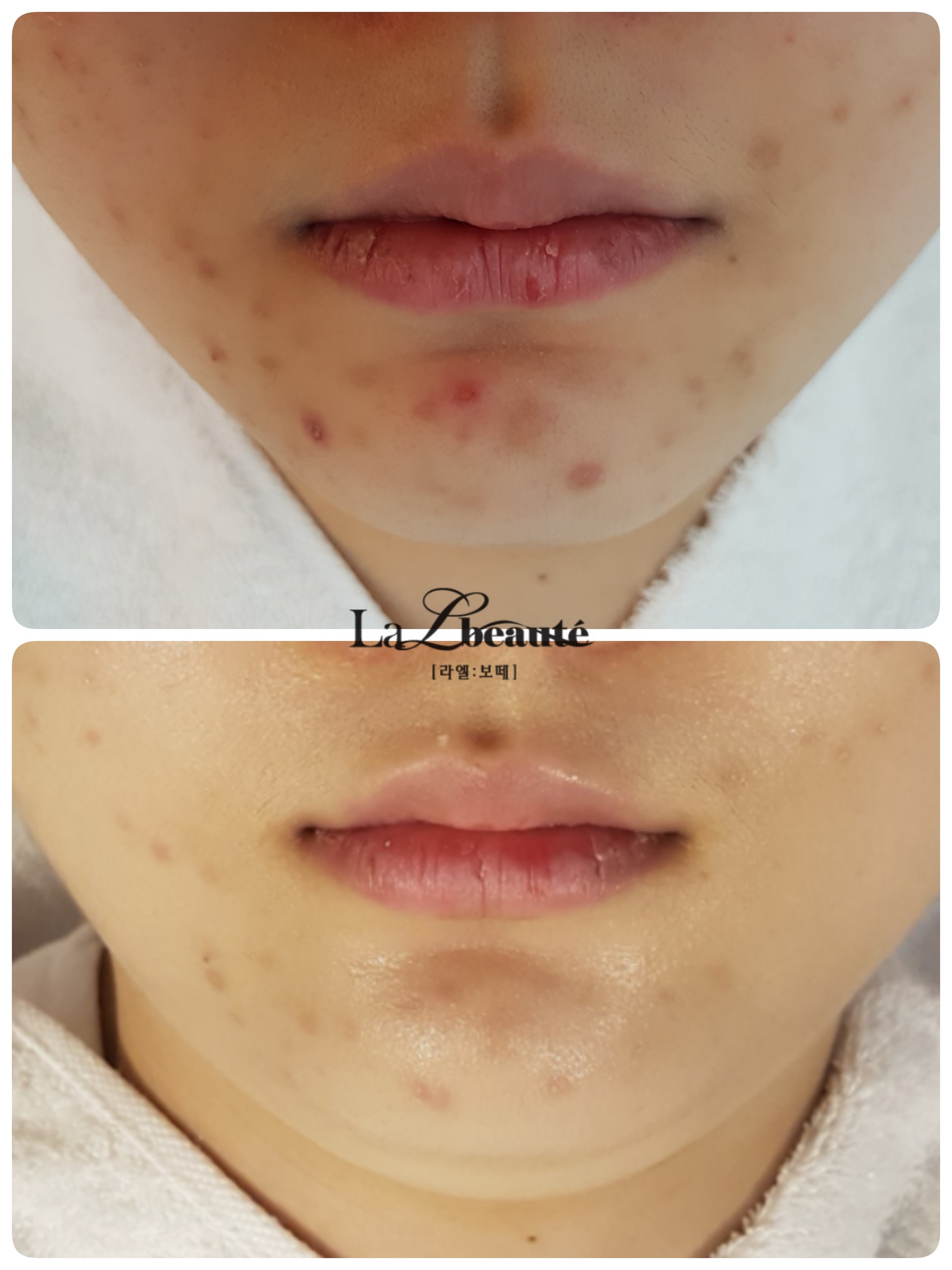 라엘보떼 대표 이미지