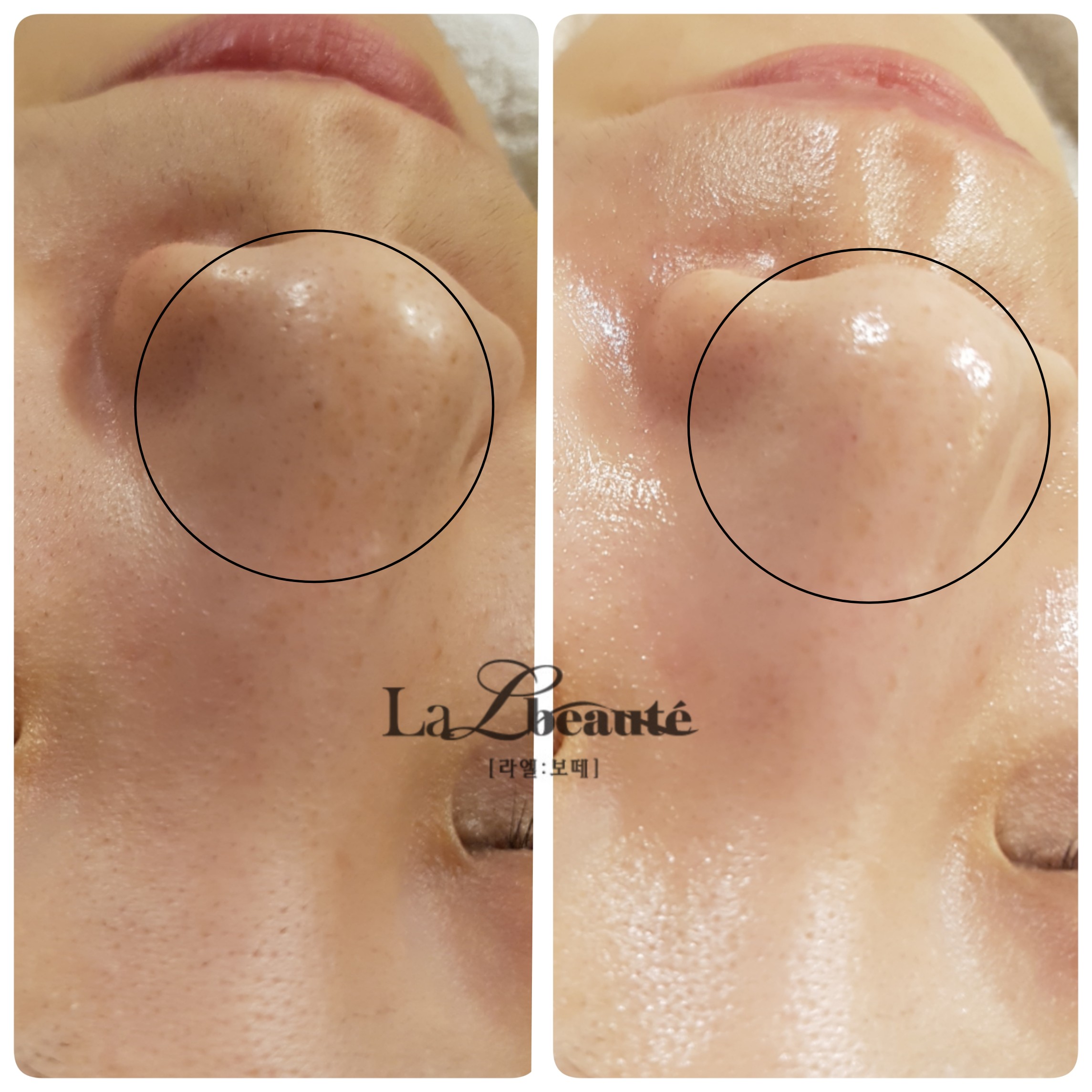 라엘보떼 대표 이미지