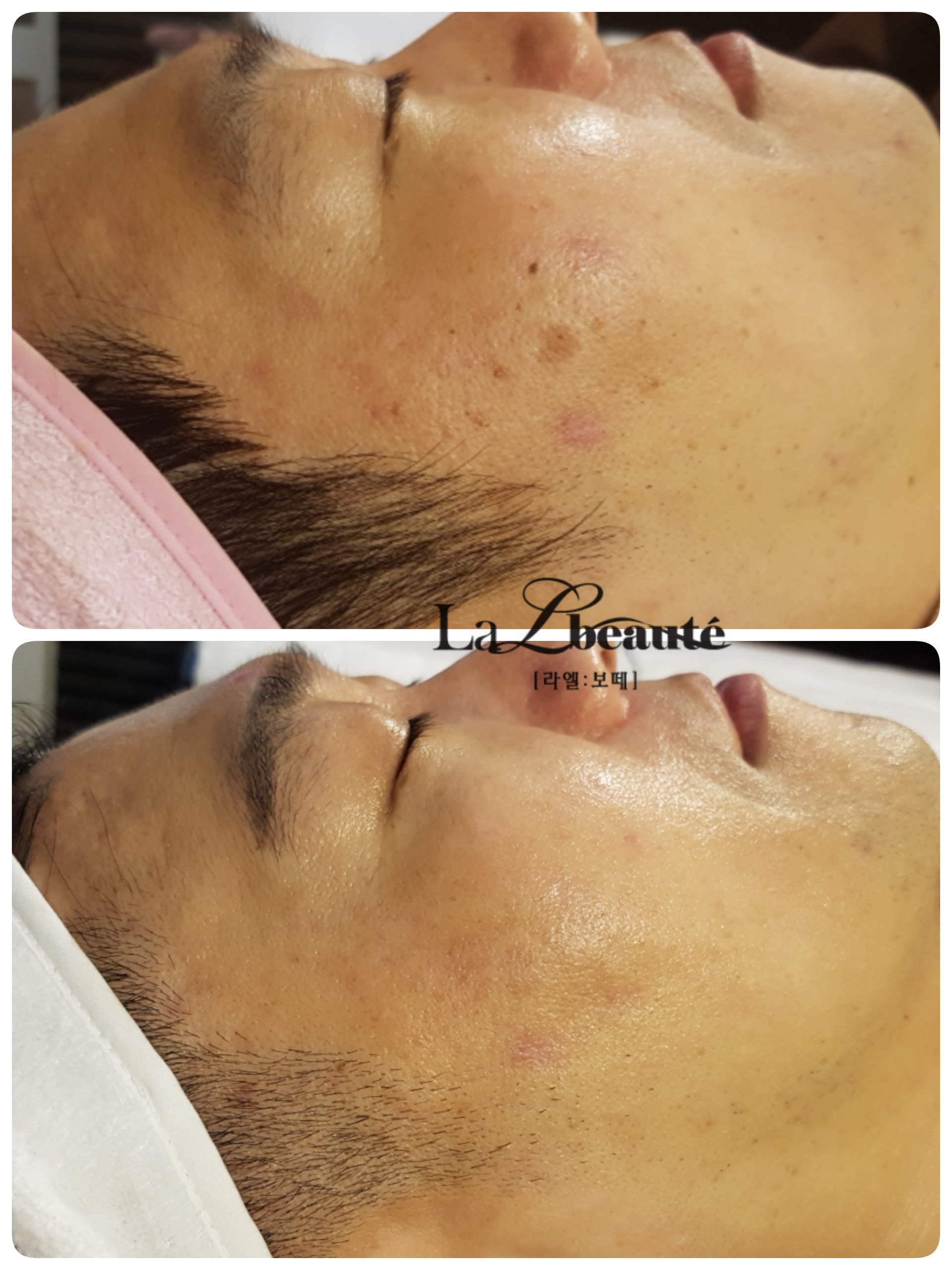 라엘보떼 대표 이미지